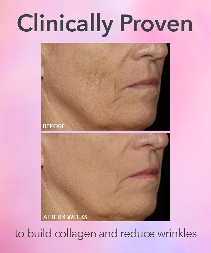 Dr. Dennis Gross DRx SpectraLite™ FaceWare Pro