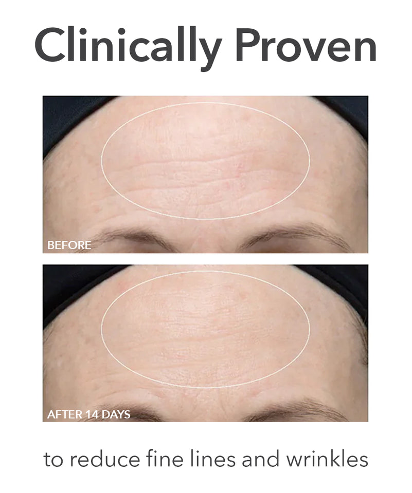 Dr Dennis Gross Alpha Beta Ultra Gentle Daily Peel (30 Count)