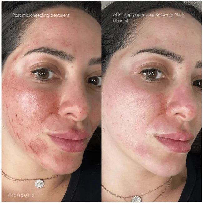 Epicutis Lipid Recovery Mask (Face)