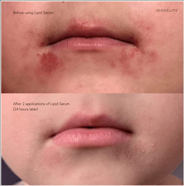 Epicutis Lipid Serum