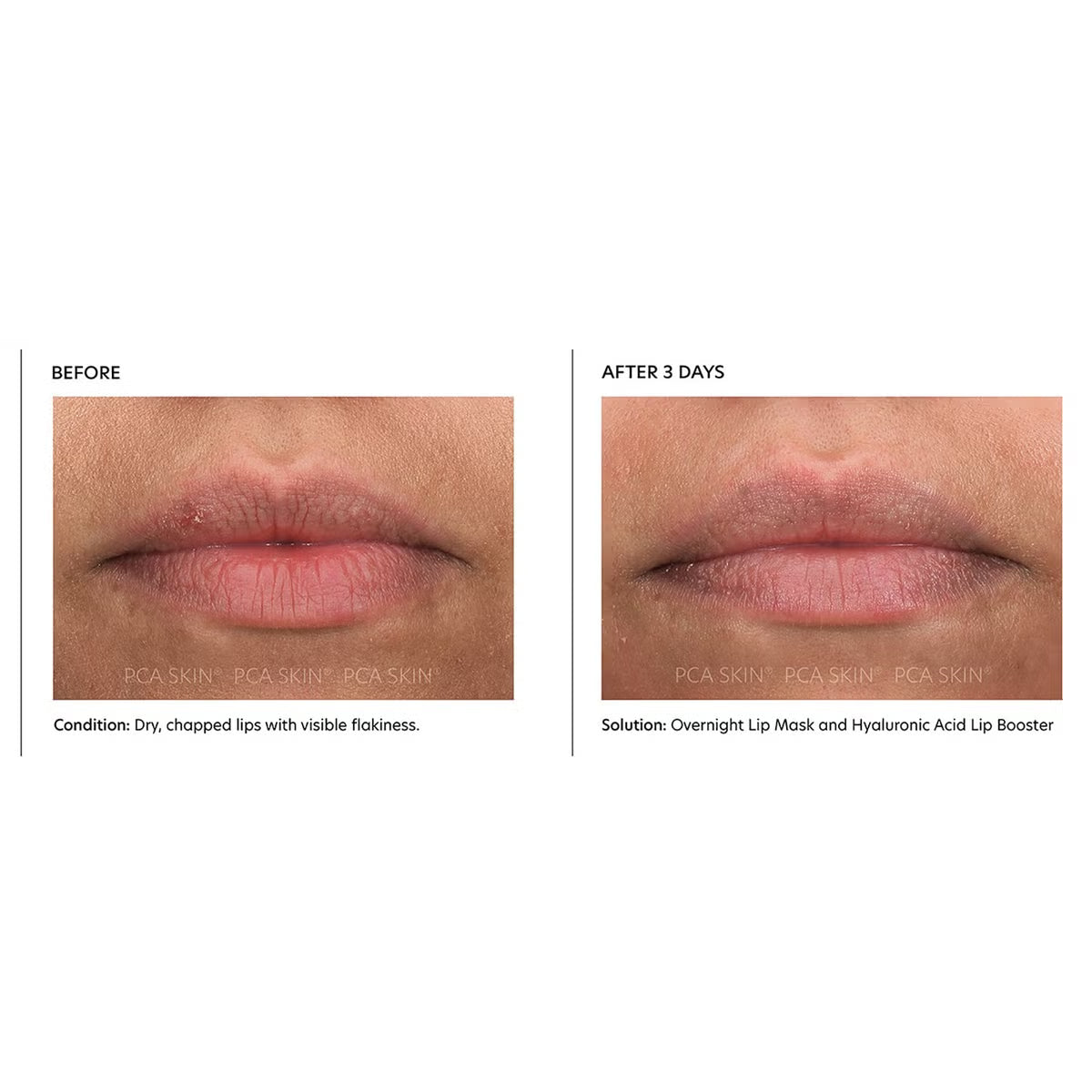 PCA Skin Overnight Lip Mask