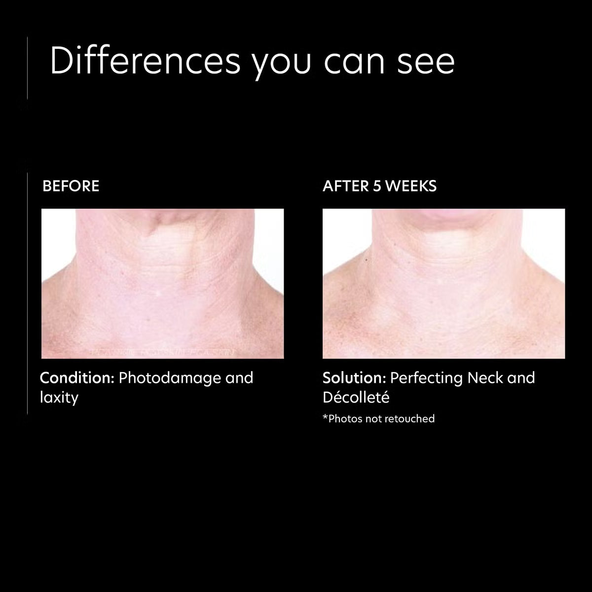 PCA Skin Perfecting Neck & Decollete