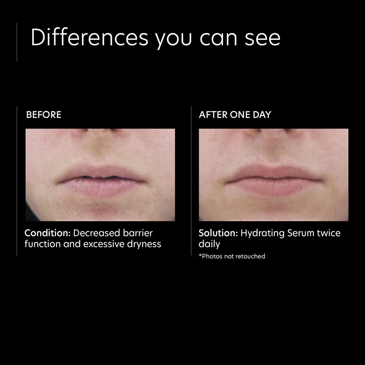 PCA Skin Hydrating Serum