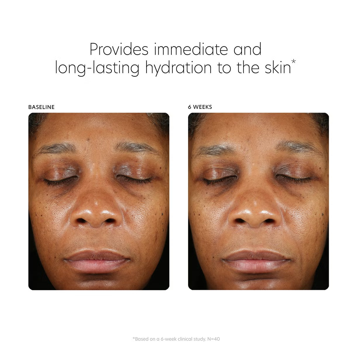 PCA Skin Hyaluronic Acid Boosting Serum