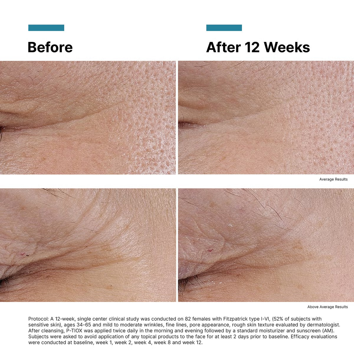 SkinCeuticals P-TIOX