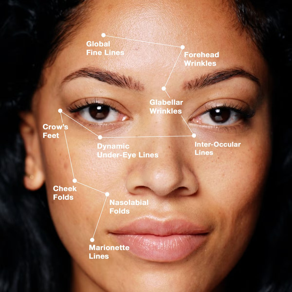 SkinCeuticals P-TIOX