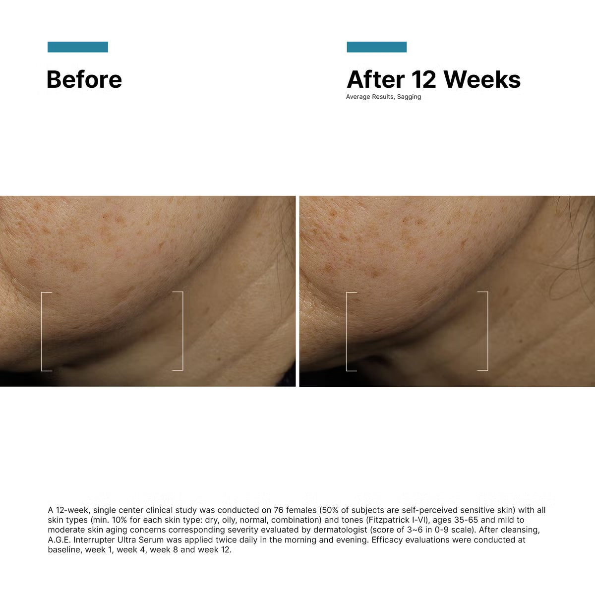 SkinCeuticals A.G.E. Interrupter Ultra Serum