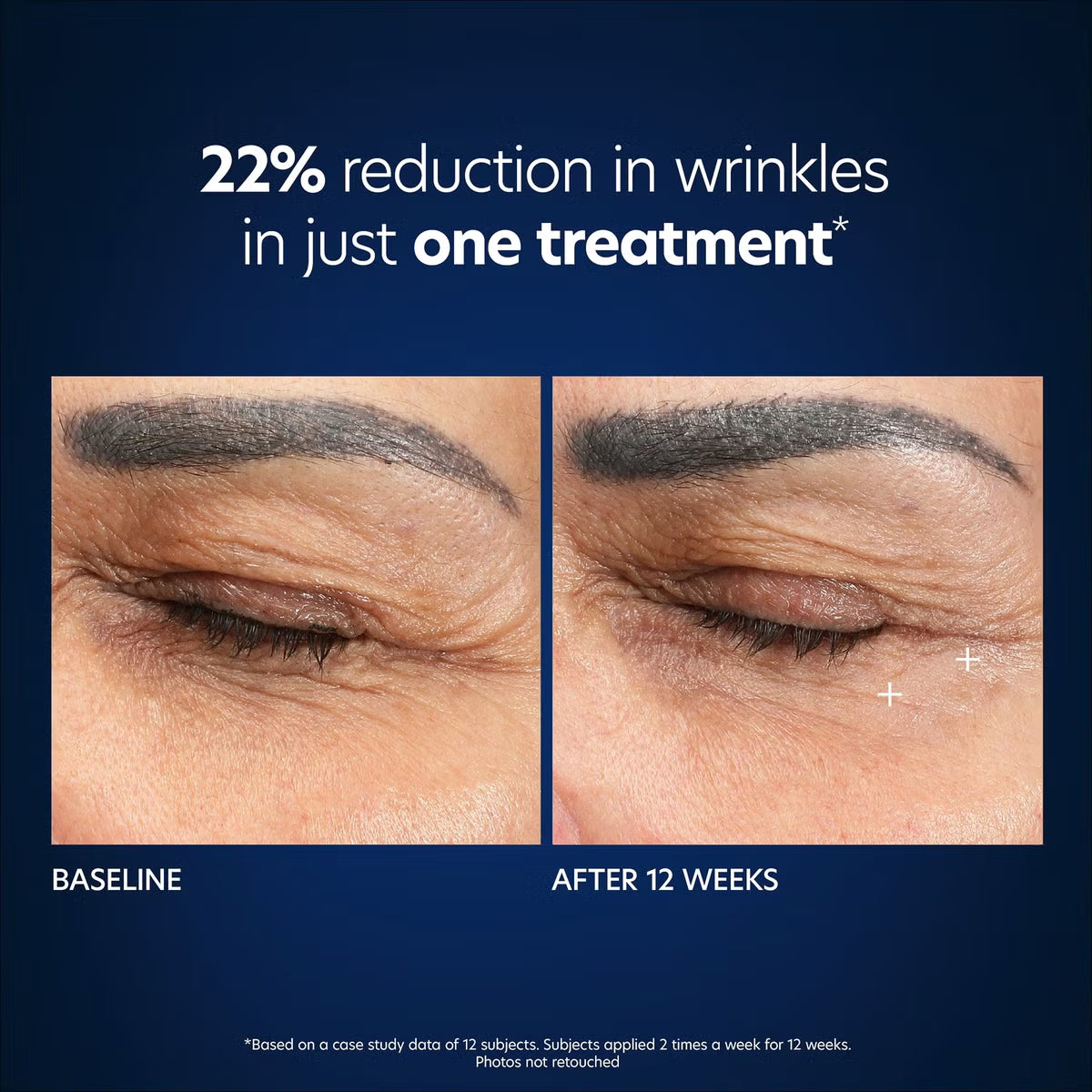 PCA Skin Hyaluronic Acid Microneedle Eye Patches (4pk)