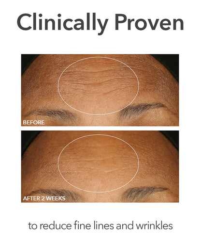 Dr Dennis Gross Alpha Beta Extra Strength Daily Peel (30 Count)