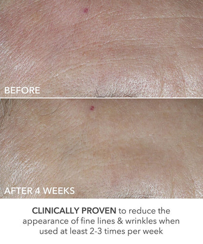 Dr Dennis Gross Advanced Retinol + Ferulic Universal 0.2% Perfectly Dosed Retinol