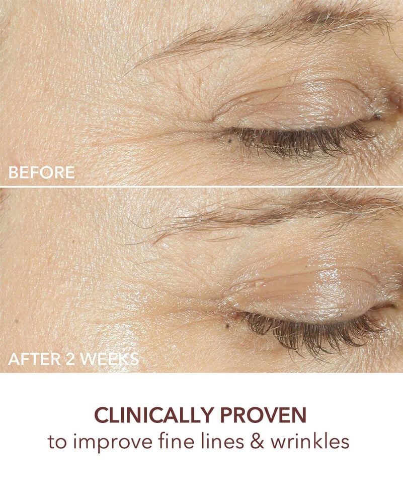 Dr Dennis Gross Advanced Retinol + Ferulic Triple Correction Eye Serum