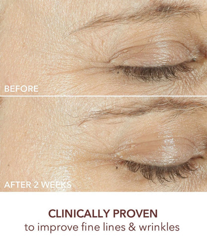 Dr Dennis Gross Advanced Retinol + Ferulic Triple Correction Eye Serum