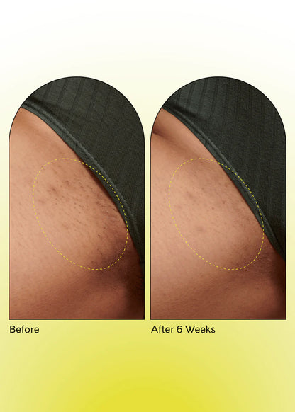 Fur Ingrown Eliminator Serum