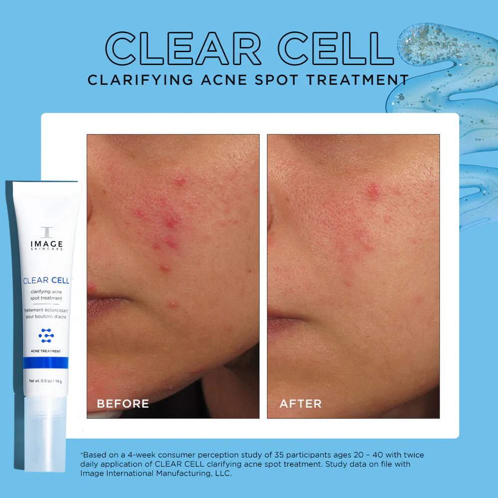 IMAGE Skincare CLEAR CELL clarifying acne spot treatment