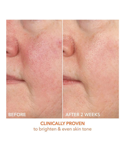 Dr Dennis Gross Vitamin C Lactic 15% Vitamin C Firm & Bright Serum