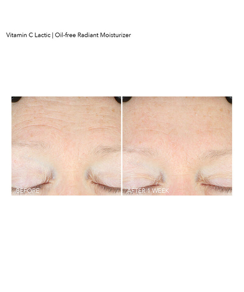 Dr Dennis Gross Vitamin C Lactic Oil-Free Radiant Moisturizer