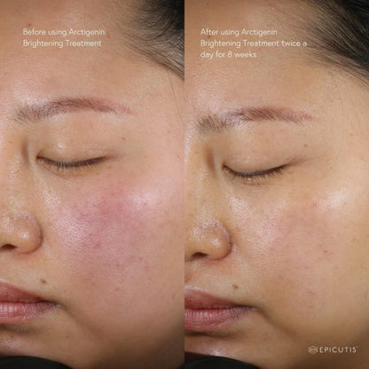 Epicutis Arctigenin Brightening Treatment