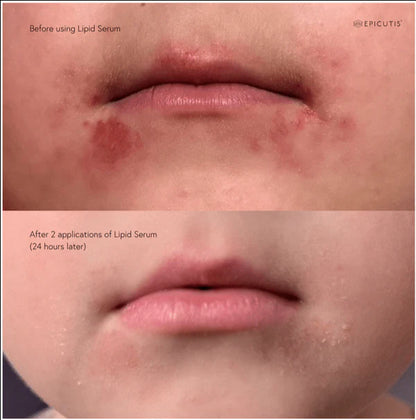 Epicutis Lipid Serum