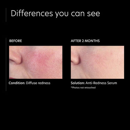 PCA Skin Anti-Redness Serum