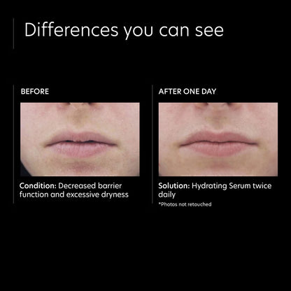 PCA Skin Hydrating Serum