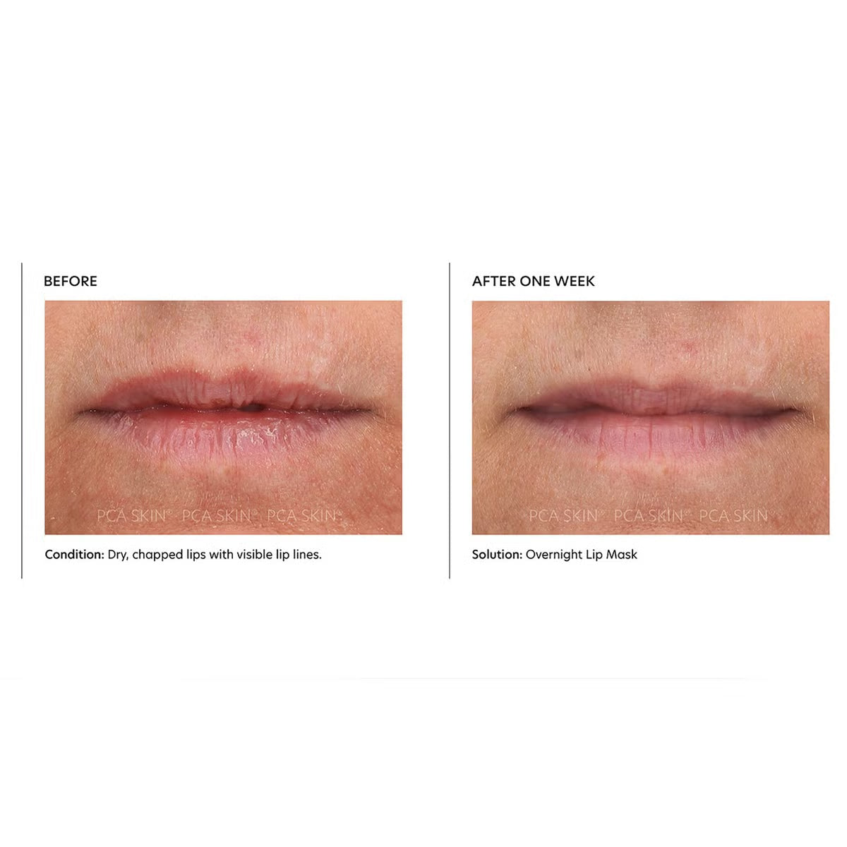 PCA Skin Overnight Lip Mask