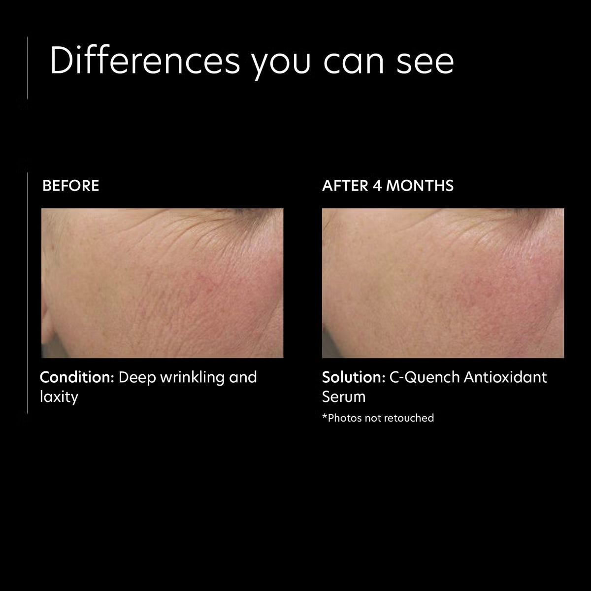 PCA Skin C-Quench Antioxidant Serum