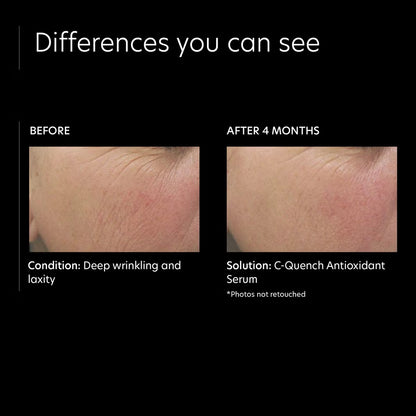 PCA Skin C-Quench Antioxidant Serum