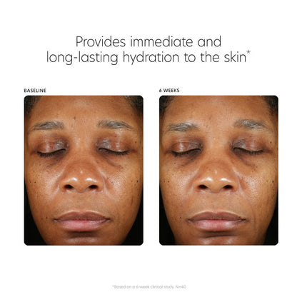 PCA Skin Hyaluronic Acid Boosting Serum