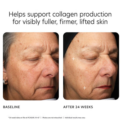 PCA Skin MGF Age Renewal Cream