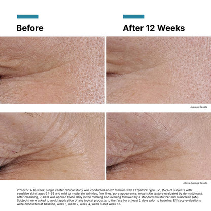 SkinCeuticals P-TIOX