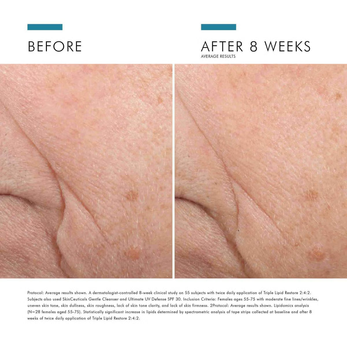 SkinCeuticals Triple Lipid Restore 2:4:2