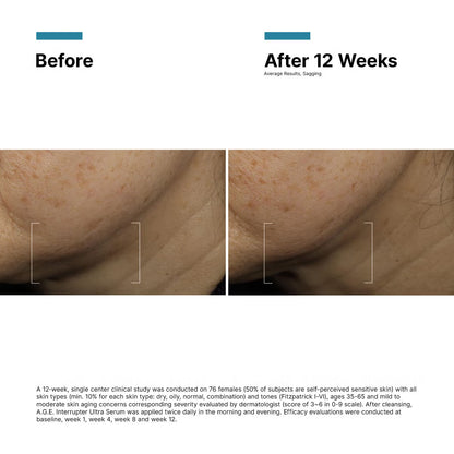SkinCeuticals A.G.E. Interrupter Ultra Serum