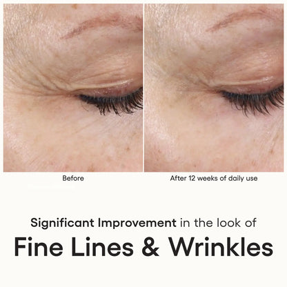 (plated) Skin Science INTENSE Serum